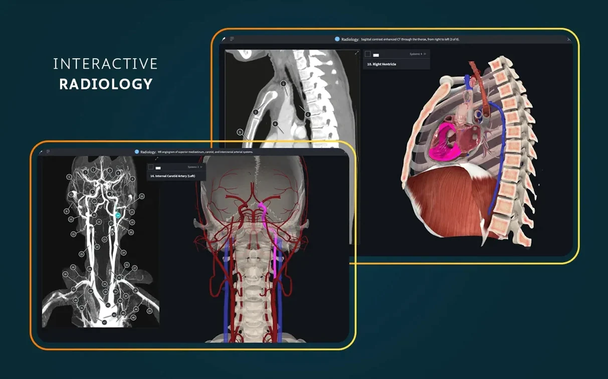 Complete Anatomy — photo 7 Complete Anatomy options, screen 7