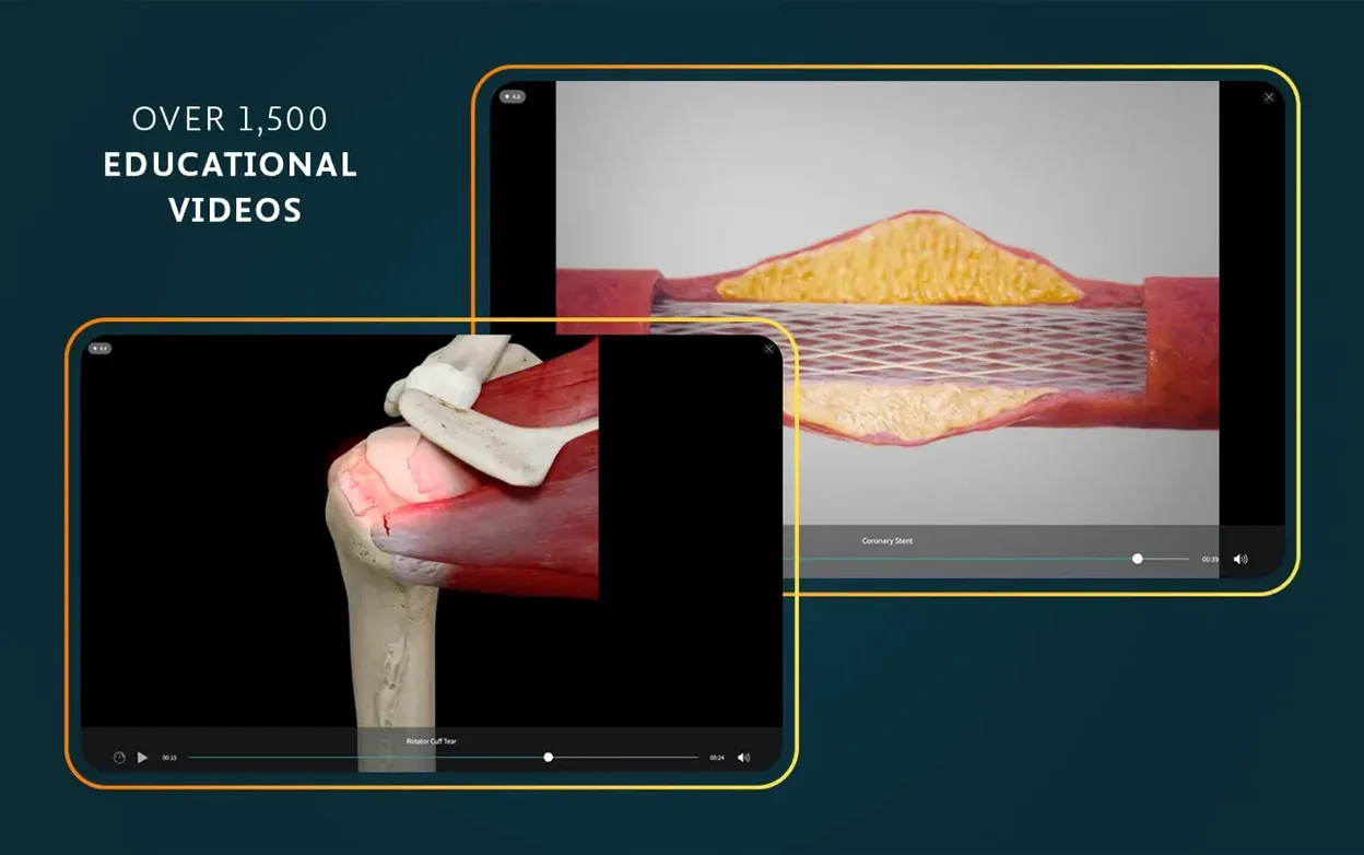 Complete Anatomy — photo 8 Complete Anatomy options, screen 8